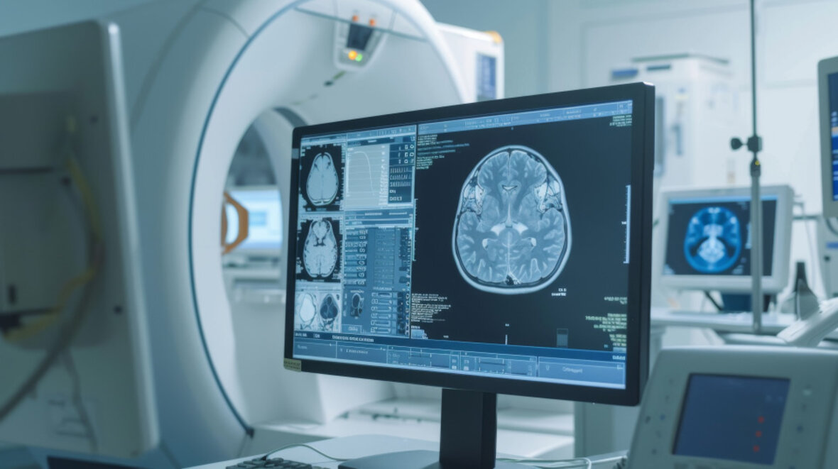 Medical monitor shows MRI image of a human brain in a diagnostic room.